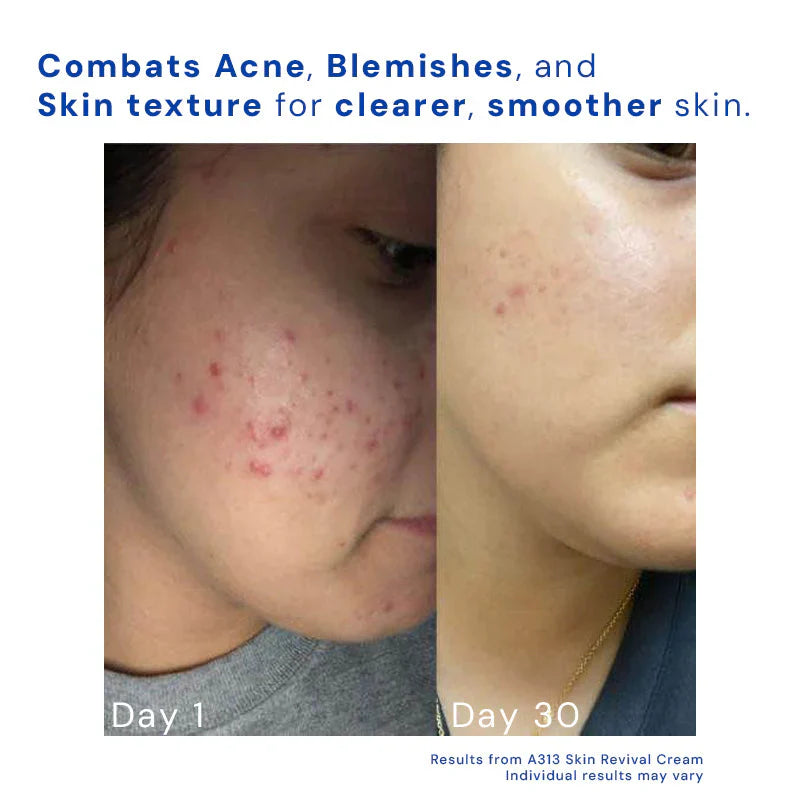 Crème de Revitalisation du Visage Viral A313