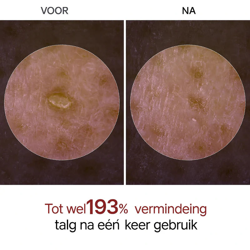 Dr. Melaxin - Rijst Peel Shot Duo glow & textuur | 1 + 1 GRATIS